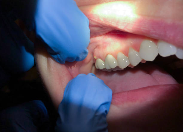 Best Emergency Treatment for Jaw Pain or Injury in St Andrews, SC